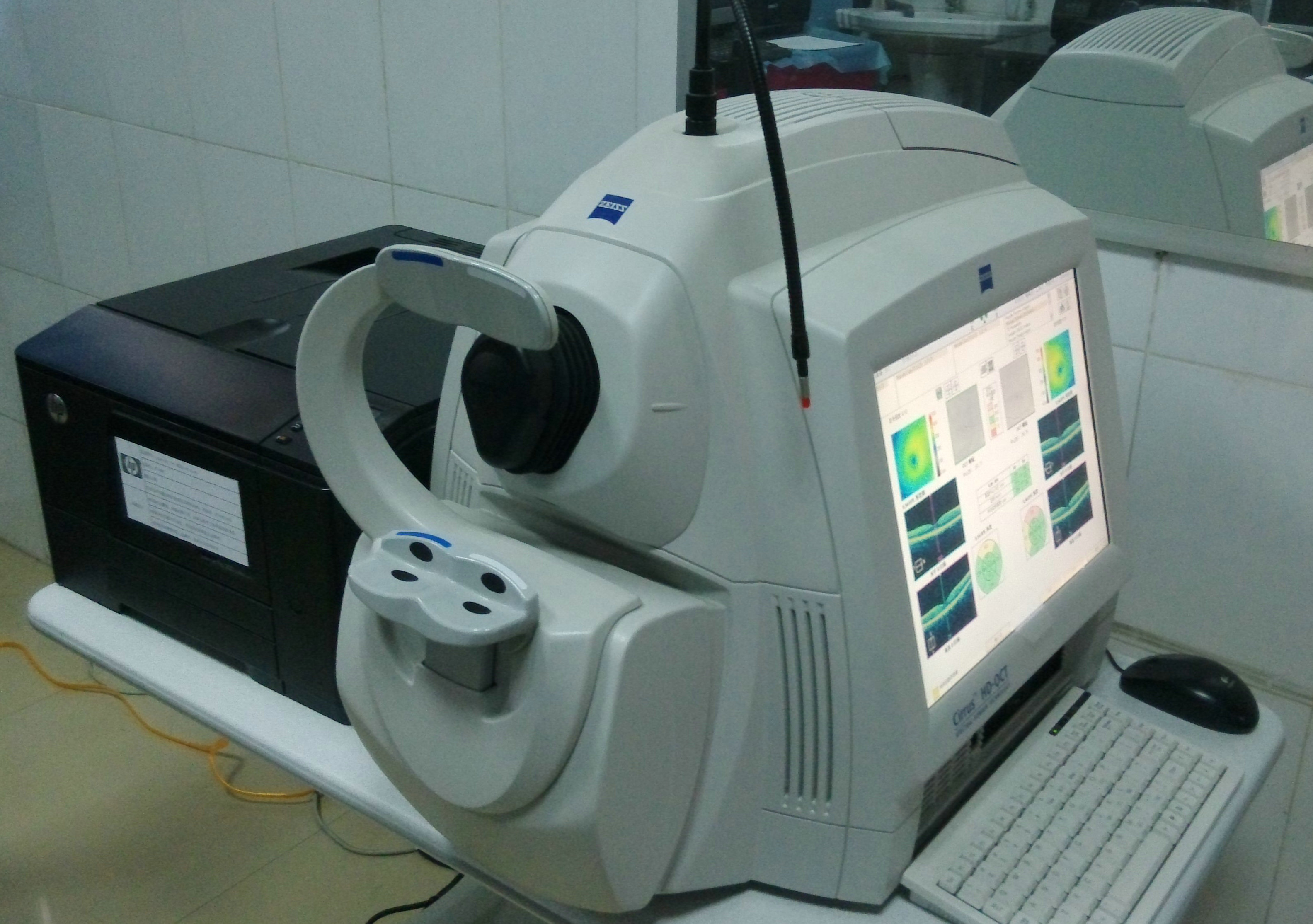 眼底光相干断层扫描检查（OCT）